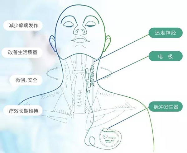 图片19.jpg 图片19.jpg