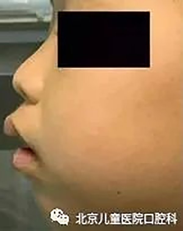 图片 5.png