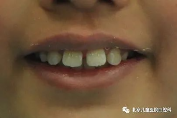 图片 9.png
