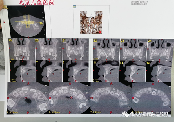 图片 95.png 图片 95.png