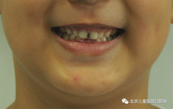 图片 109.png 图片 109.png
