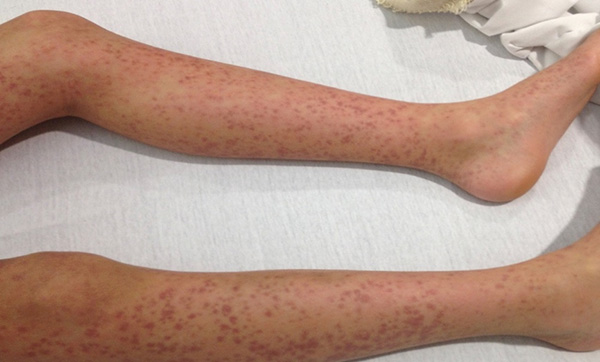 图片5.jpg 图片5.jpg