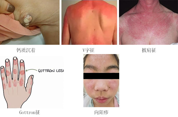 图片-2.jpg 图片-2.jpg