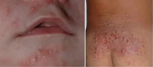 图片-22.jpg 图片-22.jpg