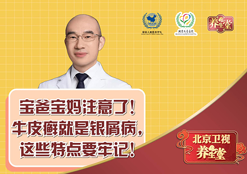 宝爸宝妈注意了！牛皮癣就是银屑病，这些特点要牢记！